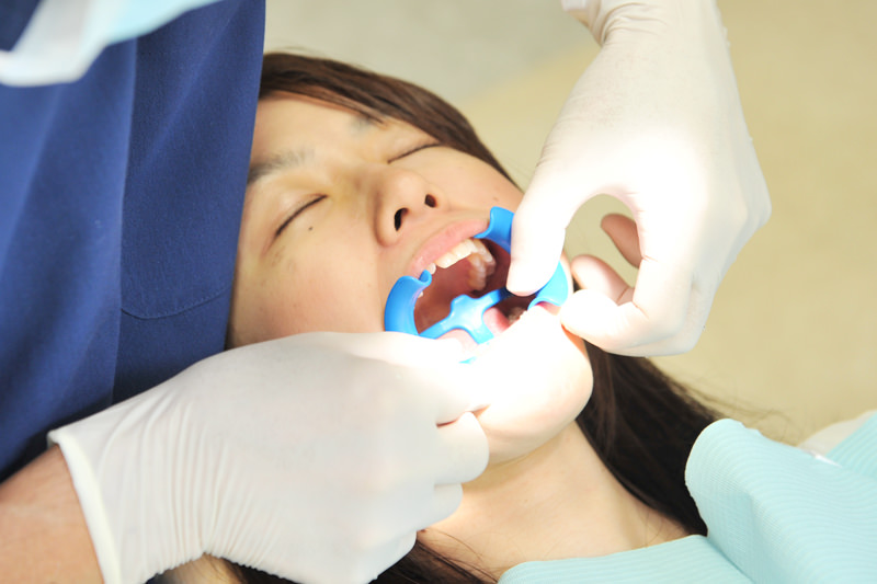 あなたの歯茎の色は健康的ですか？黒ずんでいませんか？